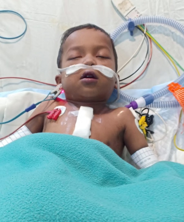 मंत्री सिंहदेव की पहल पर 5 साल की संस्कारदीप का चेन्नई में हुआ ऑपरेशन