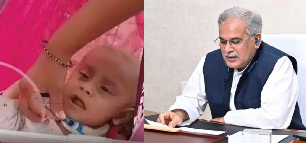 अब हर्ष को मिलेगी इलाज सम्बन्धी हर संभव मदद, मुख्यमंत्री बघेल ने लिया संज्ञान