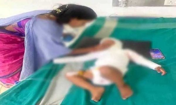  गर्म तेल में झुलसा, मासूम की मौत